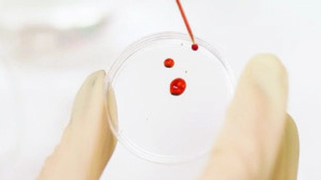 Free Online Course about Bloodborne Pathogens (BBP) from Alison