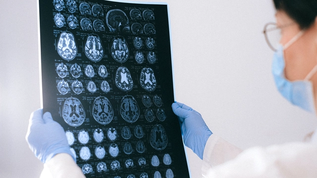 Free Online Course on Medical Neuroscience offered by Coursera