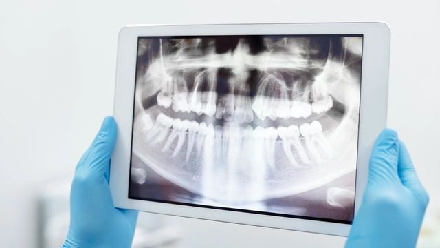 Free Online Course on offered By FutureLearn: Dental Radiography: Radiation Protection in Dental Practice